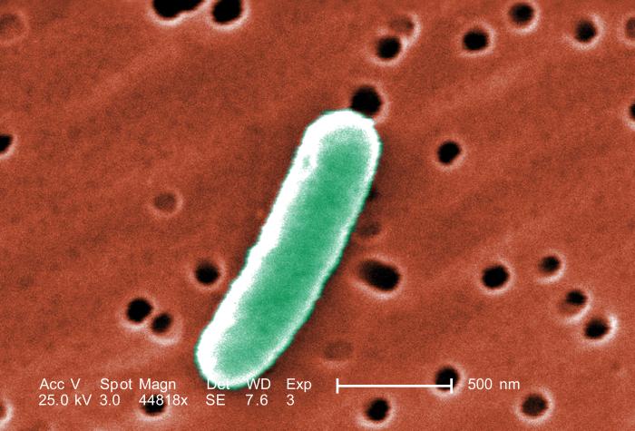 E. coli O157:H7