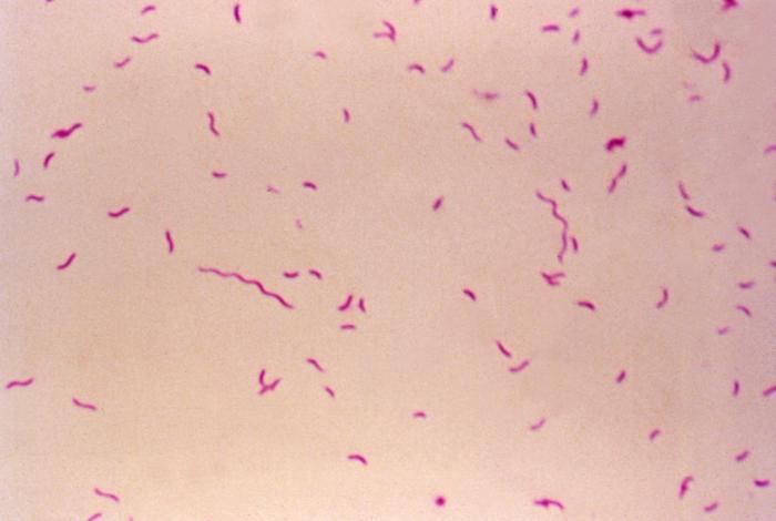 microscopic image of campylobacter